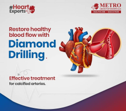 Cardiac Surgery in India